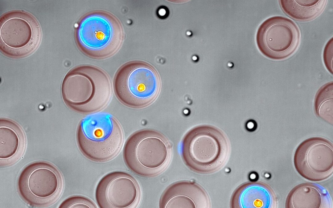 April 15, 2024 | UCLA RESEARCH BRIEF: Advance in immune cell screening uncovers receptors that target prostate cancer