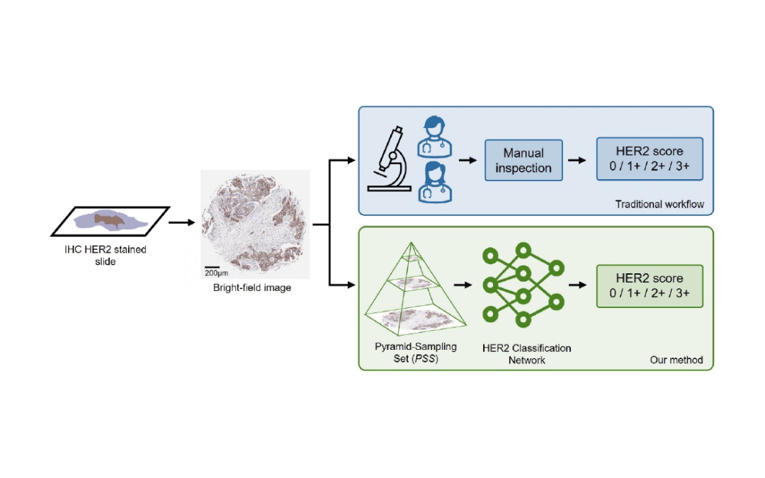 July 16, 2024 | Deep Learning Approach Enhances HER2 Scoring in Breast Cancer 